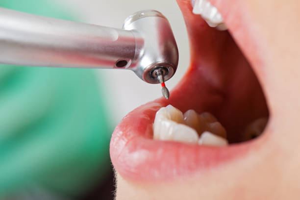 Best Chipped Tooth Repair Near Me  in South Milwaukee, WI